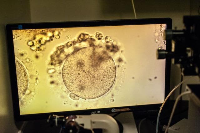 একটি ডিম্বাণুর ছবি
